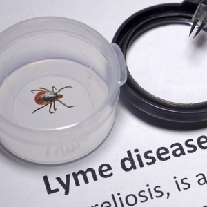 Lyme Disease: My Natural Healing Journey & What Helped