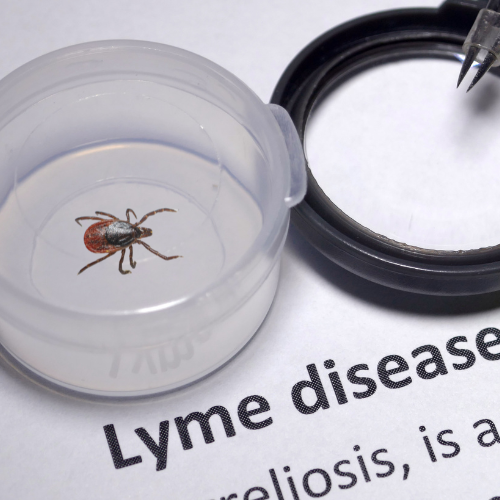 Lyme Disease 